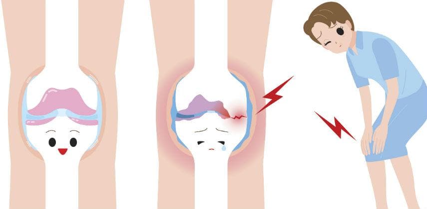 【物理自療】你了解「痛」嗎?